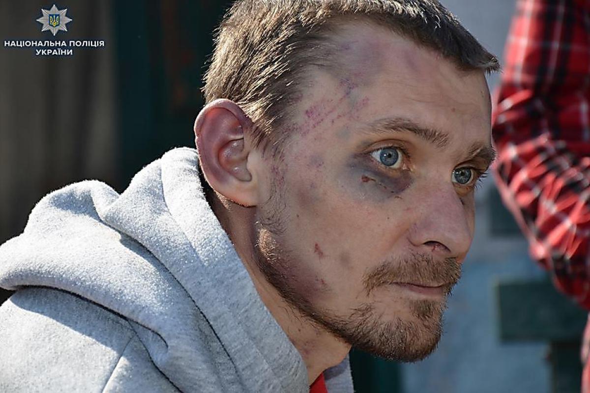 "Держал на цепи и заставлял работать": на Луганщине мужчина истязал подсобных рабочих "Держал на цепи и заставлял работать": на Луганщине мужчина истязал подсобных рабочих