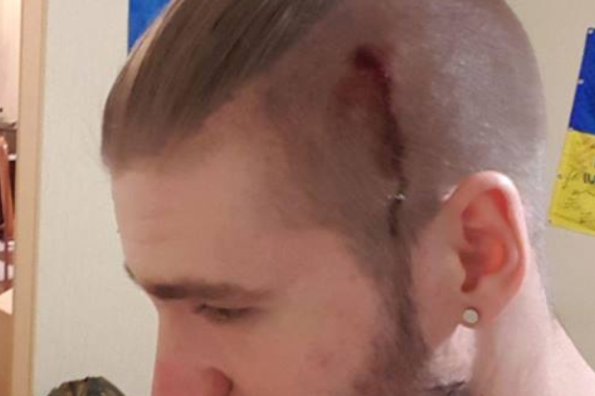 Пошел за гречкой и получил по голове: в Киеве бойцу ВСУ разбили голову Пошел за гречкой и получил по голове: в Киеве бойцу ВСУ разбили голову