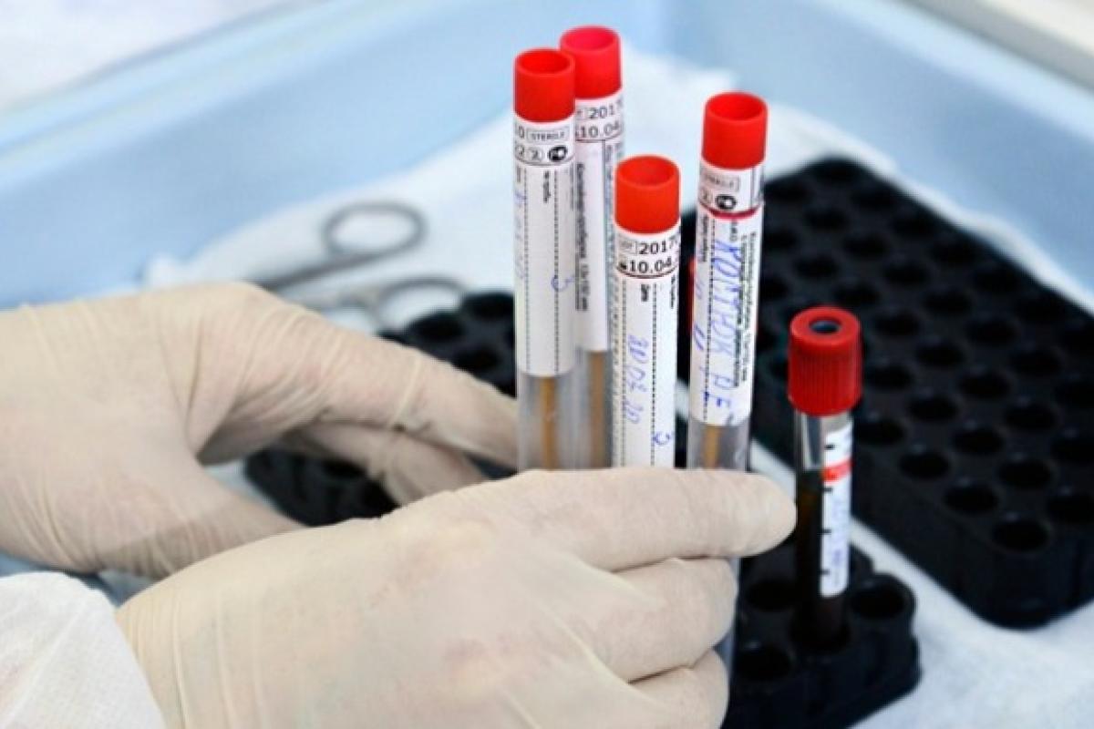 COVID-19 в Украине: за сутки выявлено более 3700 новых случаев COVID-19 в Украине: за сутки выявлено более 3700 новых случаев