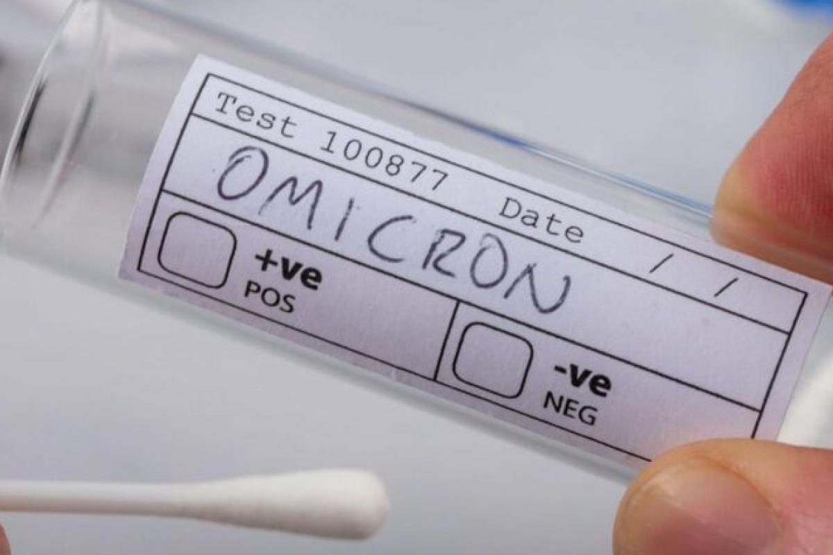 У Німеччині зафіксували першу смерть від штаму "Омікрон" У Німеччині зафіксували першу смерть від штаму "Омікрон"