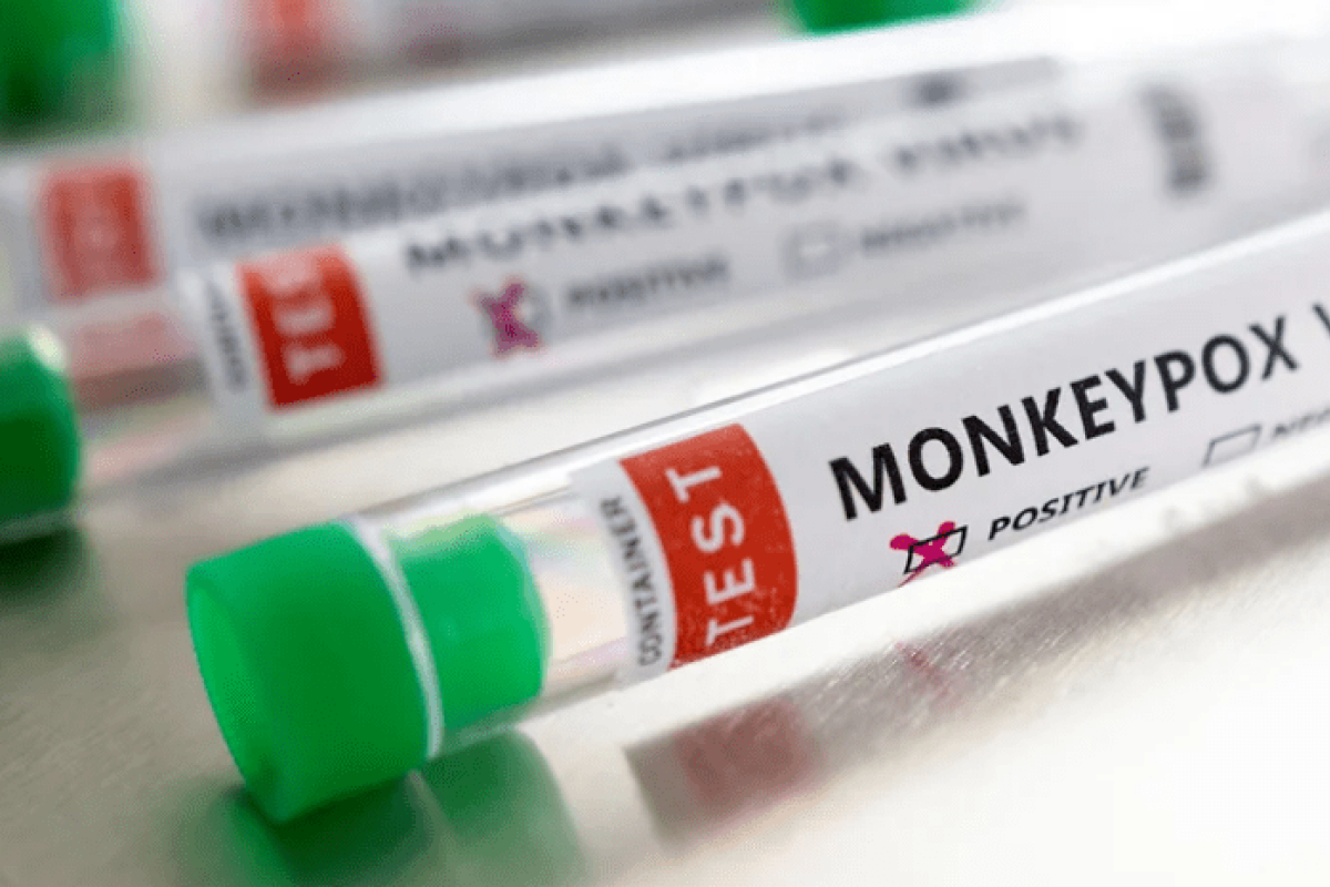 У Європі зафіксовано першу смерть від віспи мавп У Європі зафіксовано першу смерть від віспи мавп