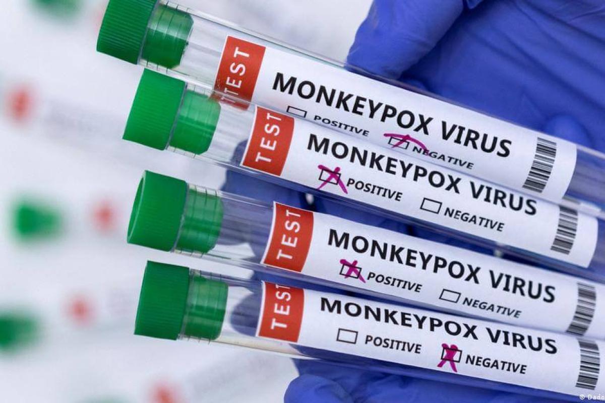 В Великобритании выявлен новый штамм оспы обезьян В Великобритании выявлен новый штамм оспы обезьян