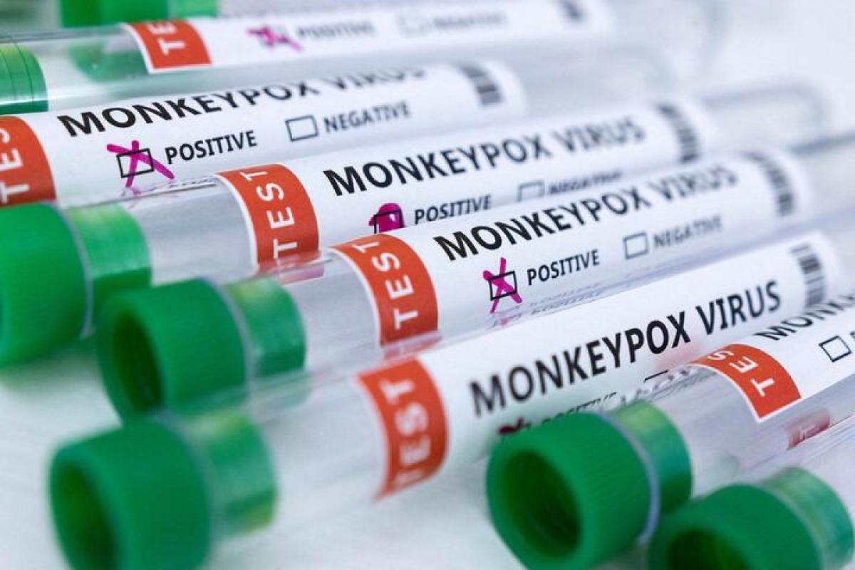 В Африці за тиждень сотні людей заразилися вірусом мавп'ячої віспи, є летальні випадки В Африці за тиждень сотні людей заразилися вірусом мавп'ячої віспи, є летальні випадки
