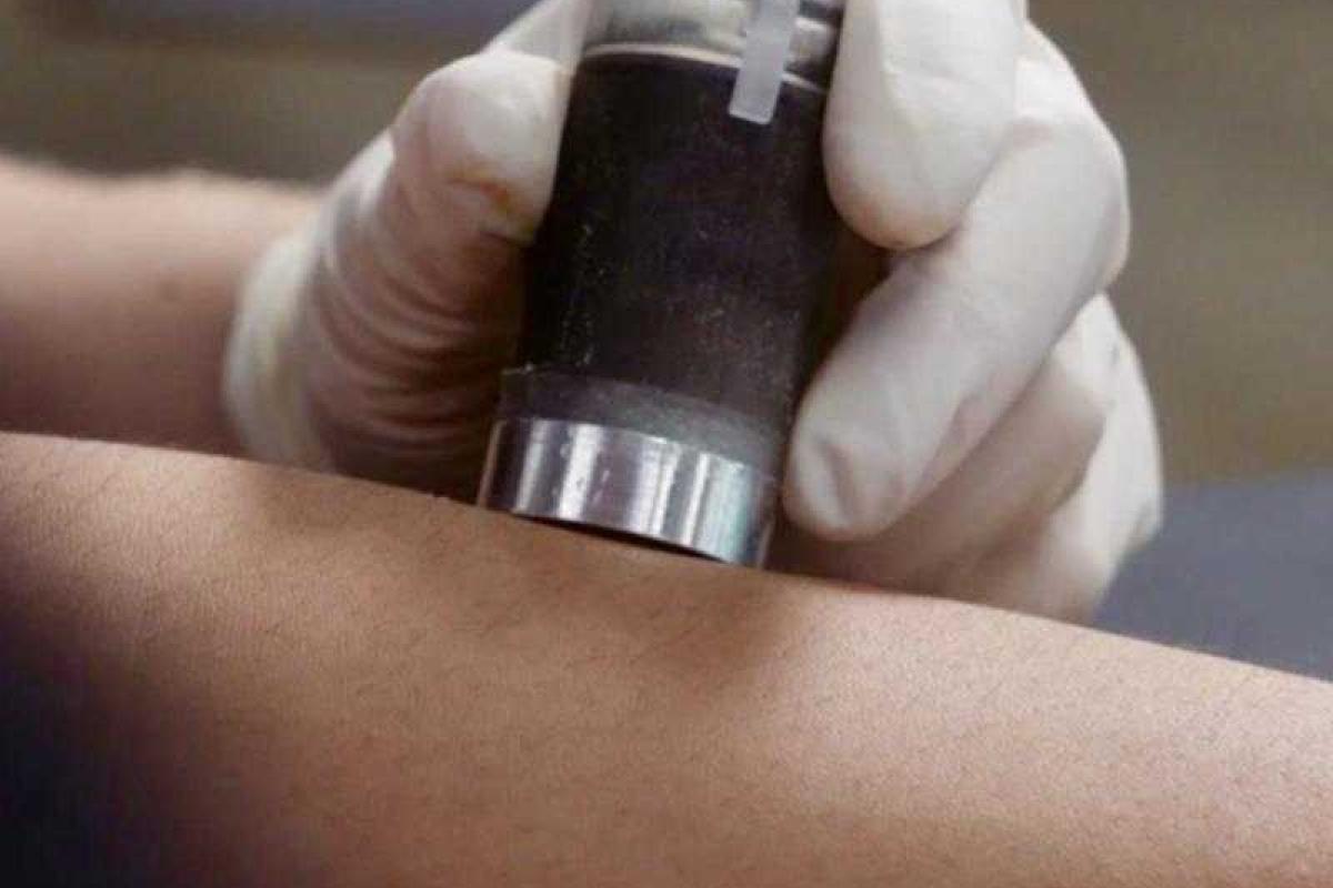 Новое устройство позволяет делать уколы менее болезненными