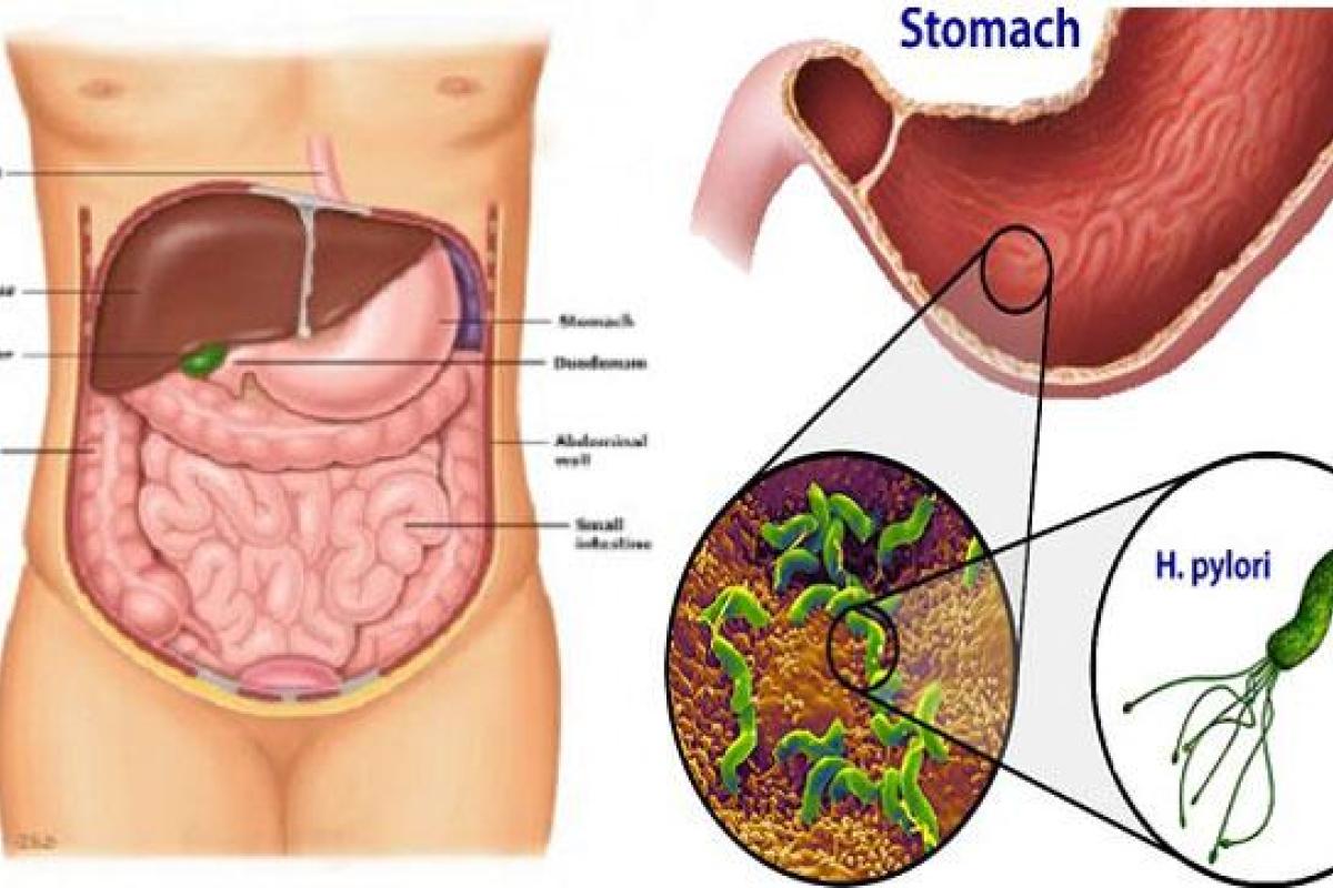 Как лечить гастрит у ребенка?