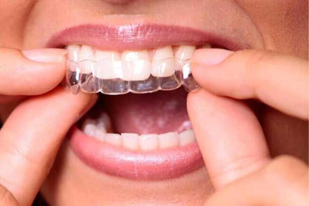 Лікування бруксизму в Києві