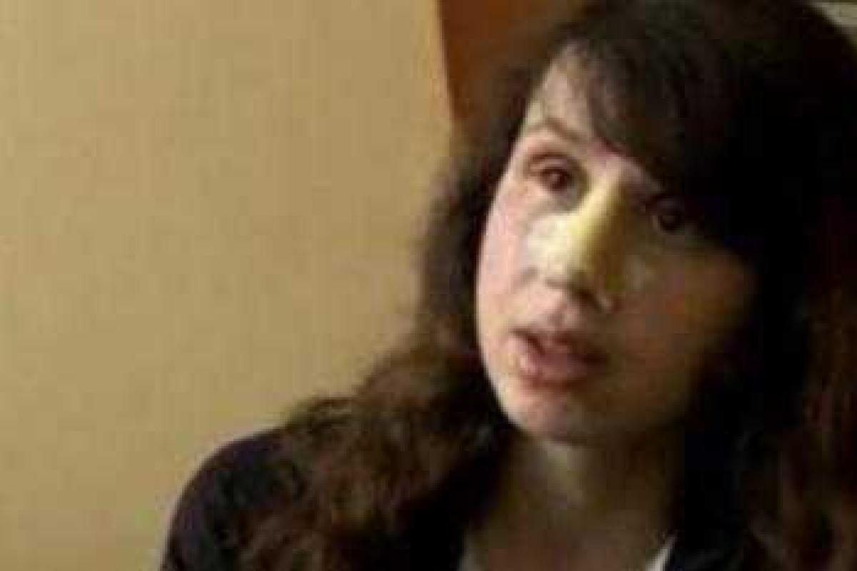 МВД получило результаты экспертиз по делу Черновол