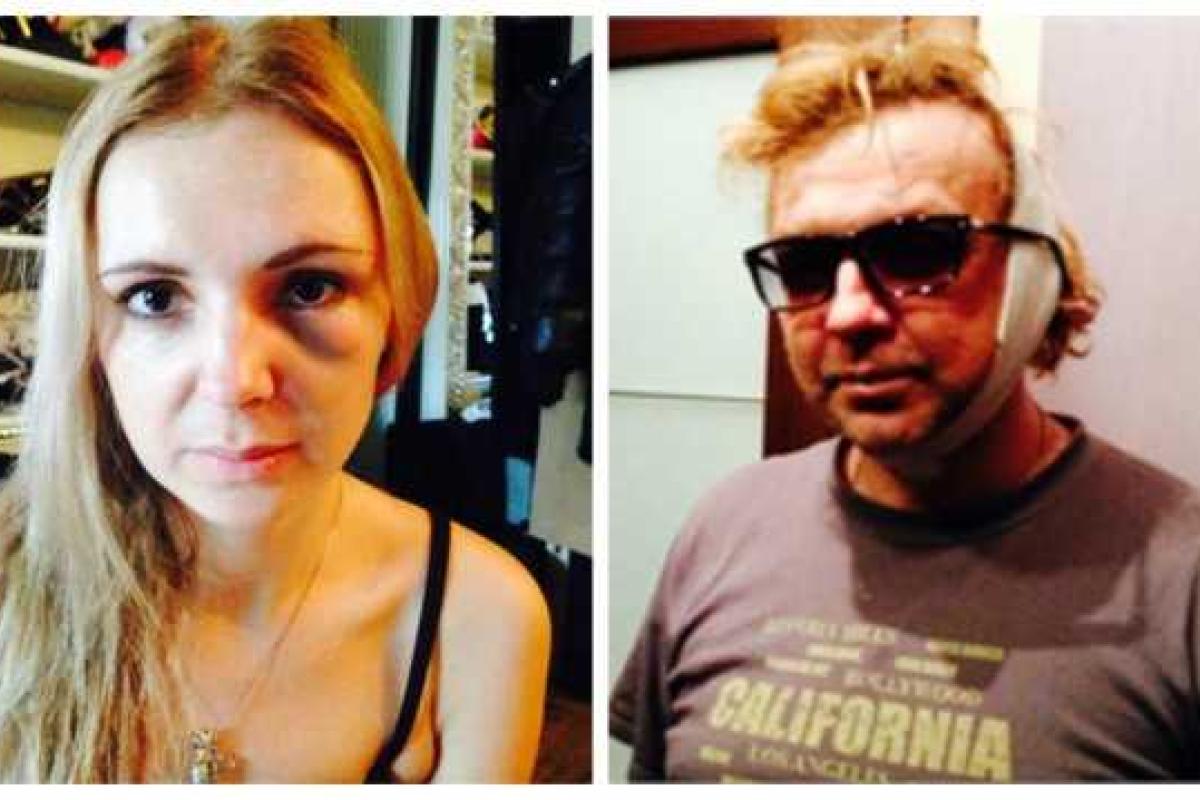 Российского певца и его жену избили после концерта 