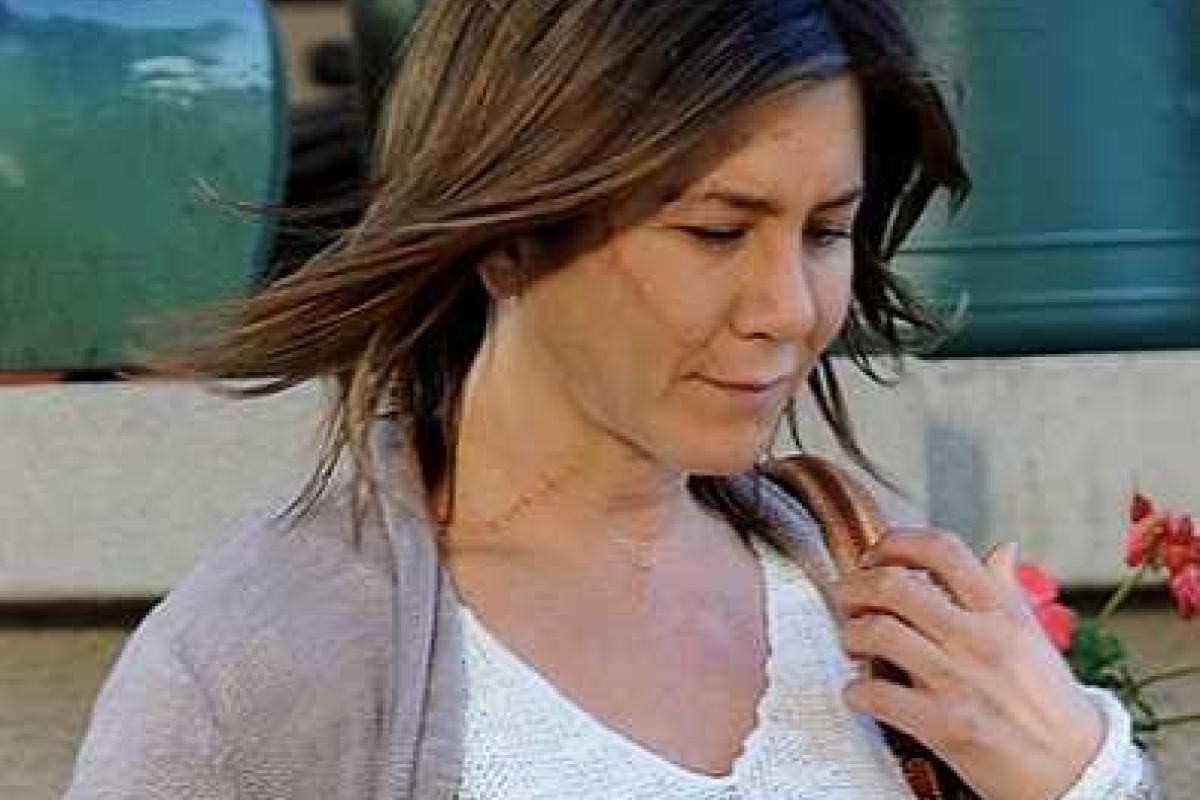 На лице Дженнифер Энистон появился ужасный шрам На лице Дженнифер Энистон появился ужасный шрам