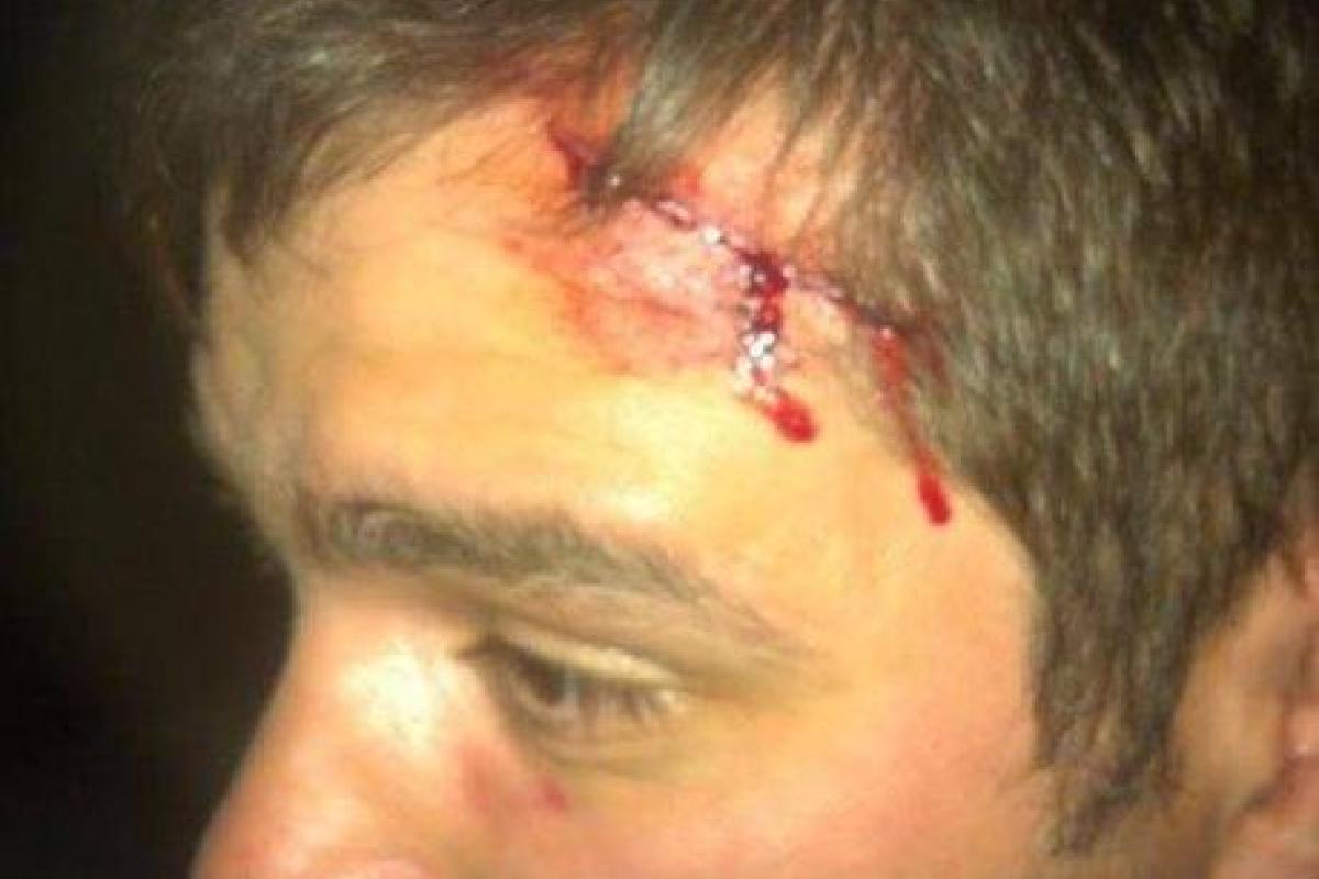 В Киеве избили кандидата в депутаты Киевсовета от "Свободы"