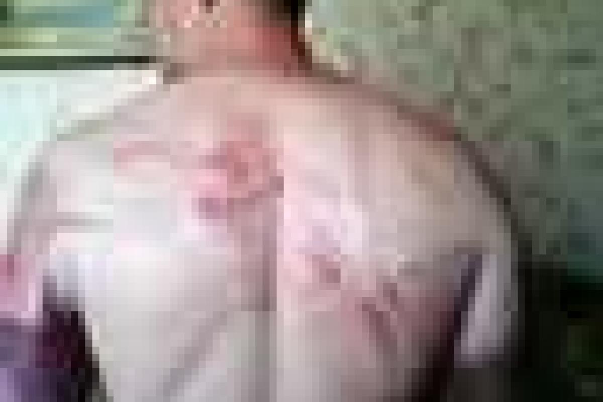 Пастор, побывавший в плену у боевиков "ДНР", показал, что они с ним сделали 