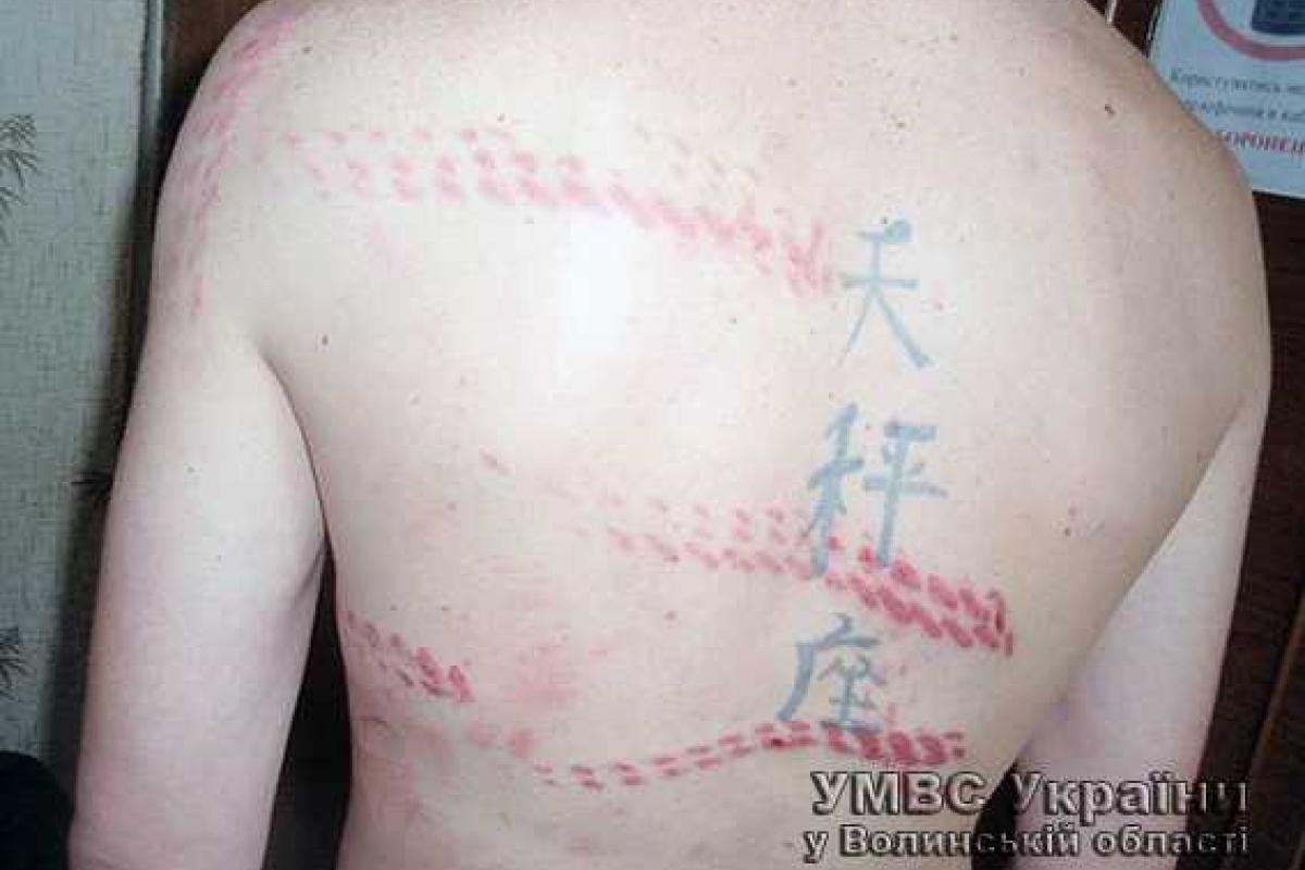 Жителя Волыни избили цепью и обожгли раскаленными плоскогубцами