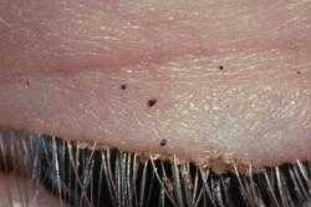 У китаянки из глаза вытащили 20 вшей У китаянки из глаза вытащили 20 вшей