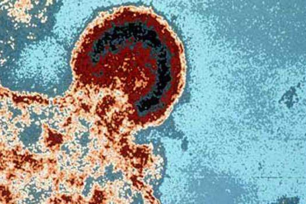 Во Франции зафиксирован первый случай ремиссии ВИЧ в течение 12 лет