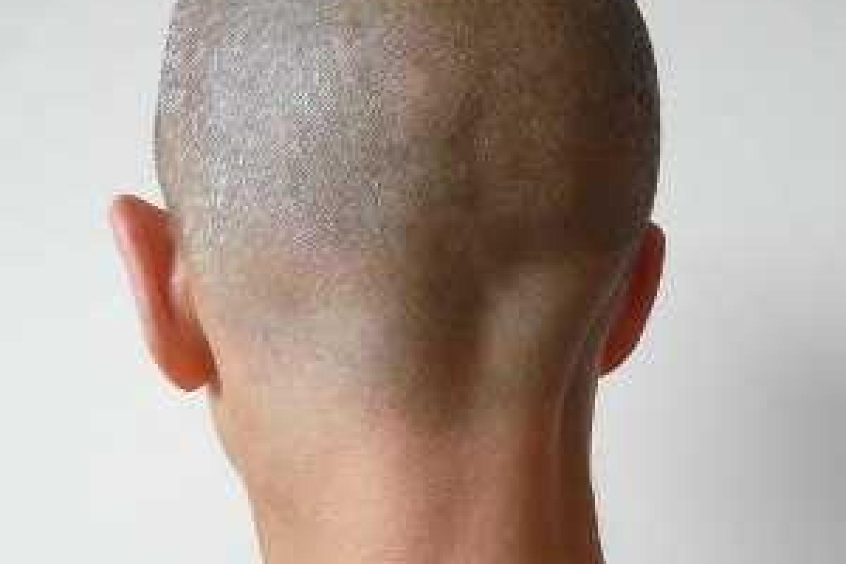 В России больного раком парня выгнали из парикмахерской