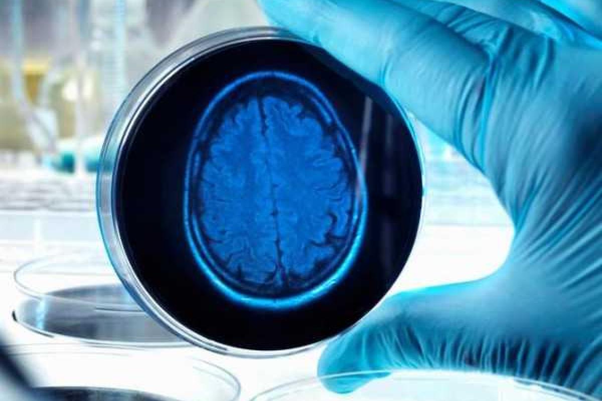 Американские ученые вырастили в лаборатории копию человеческого мозга Американские ученые вырастили в лаборатории копию человеческого мозга