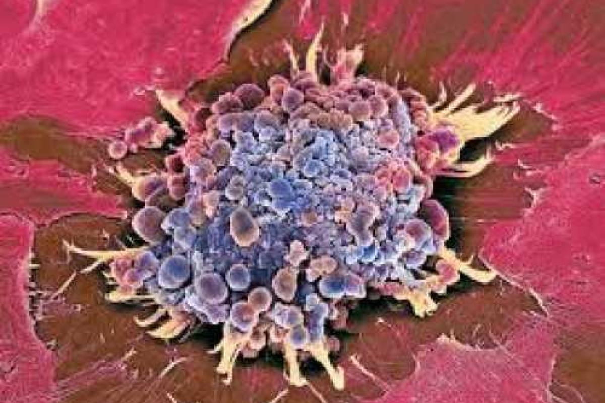 Ученые научились превращать раковые клетки в здоровые