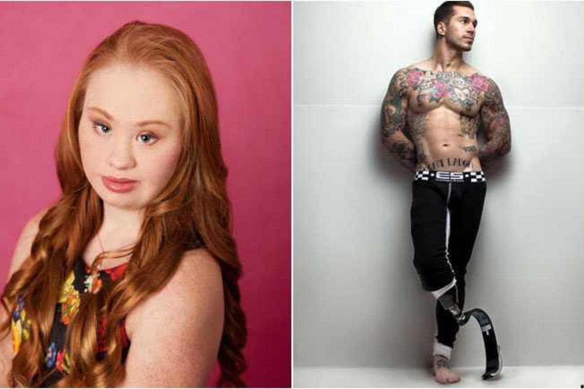 10 самых нестандартных моделей, работающих в индустрии моды