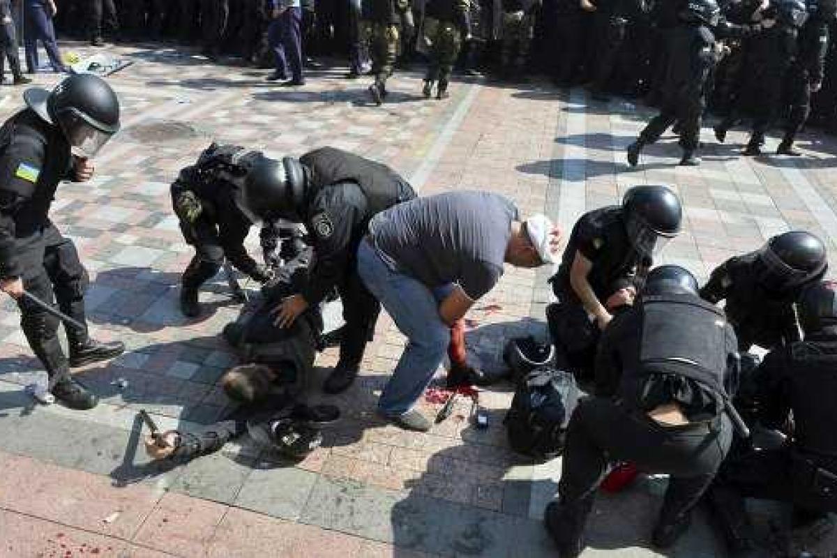 Скончался еще один нацгвардеец, пострадавший под ВР 31 августа 