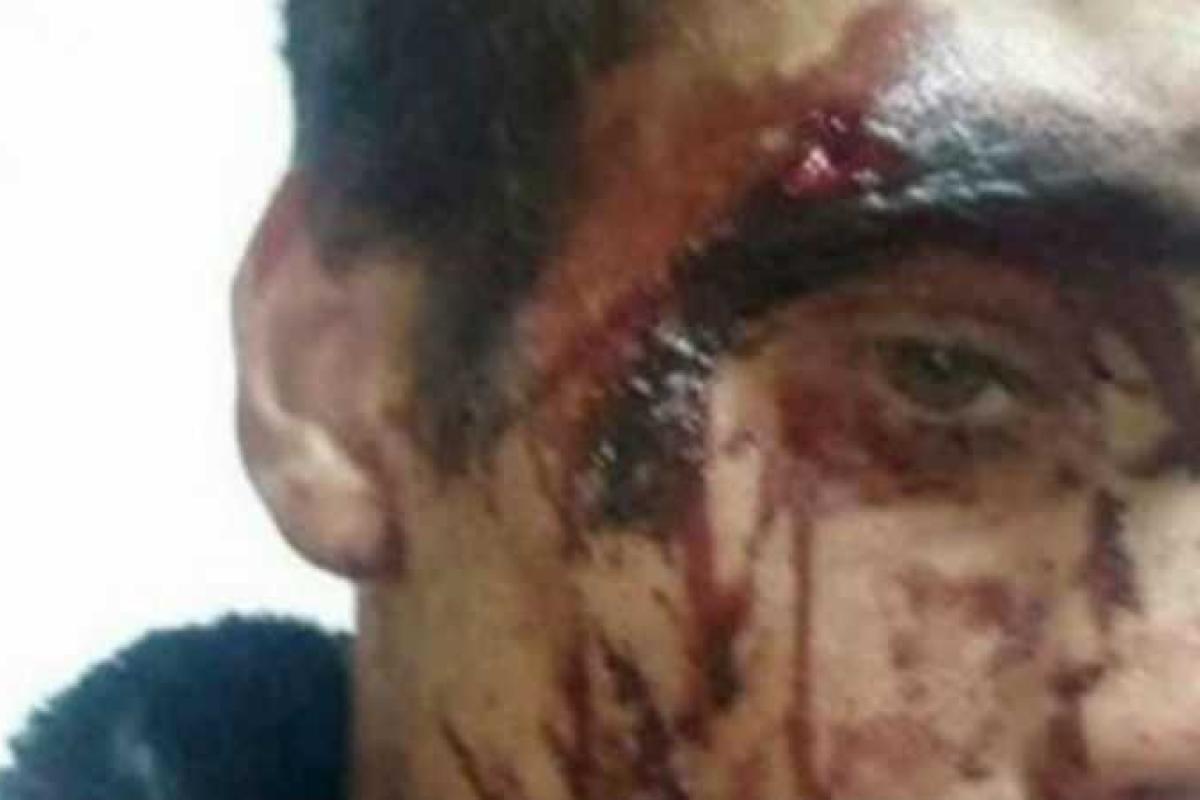 В России жестоко избили беженцев из Донбасса В России жестоко избили беженцев из Донбасса