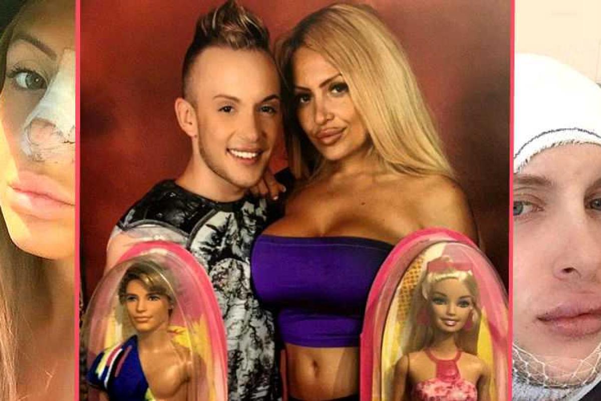 Россиянка и француз решили стать пластиковыми куклами