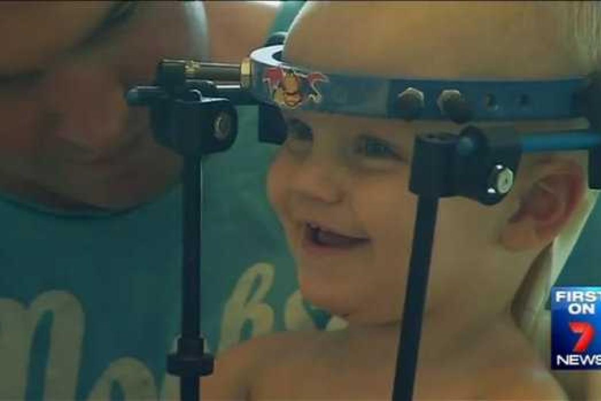 Австралийские медики спасли ребенка после внутреннего обезглавливания