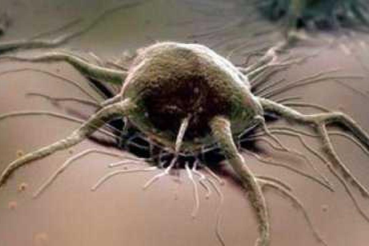 Ученые установили, что рак может грозить всем детям 