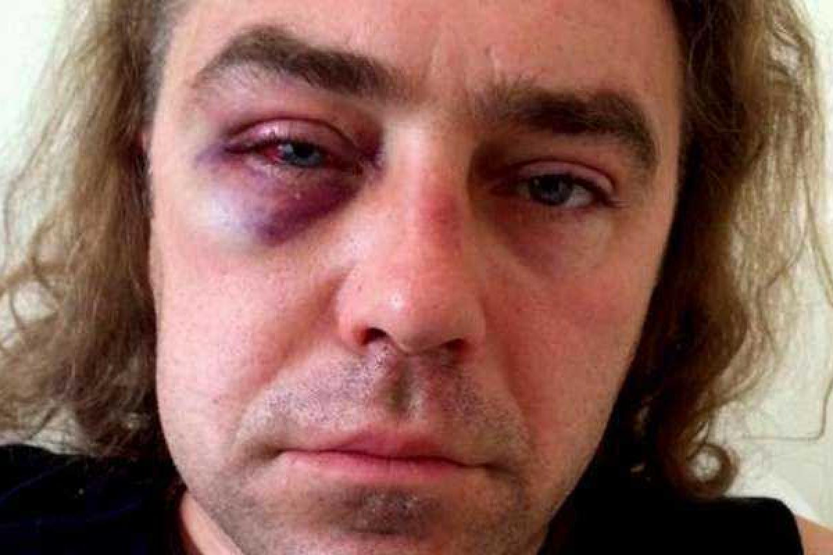 Общественность отреагировала на инцидент из екс-надепом Мирошниченко