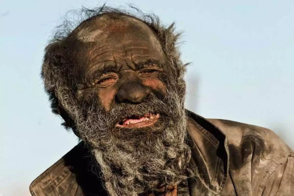 В Иране живет мужчина, который не мылся 60 лет В Иране живет мужчина, который не мылся 60 лет