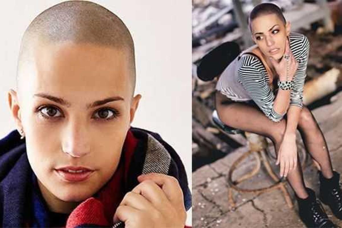 Девушка со страшным диагнозом поражает своей красотой