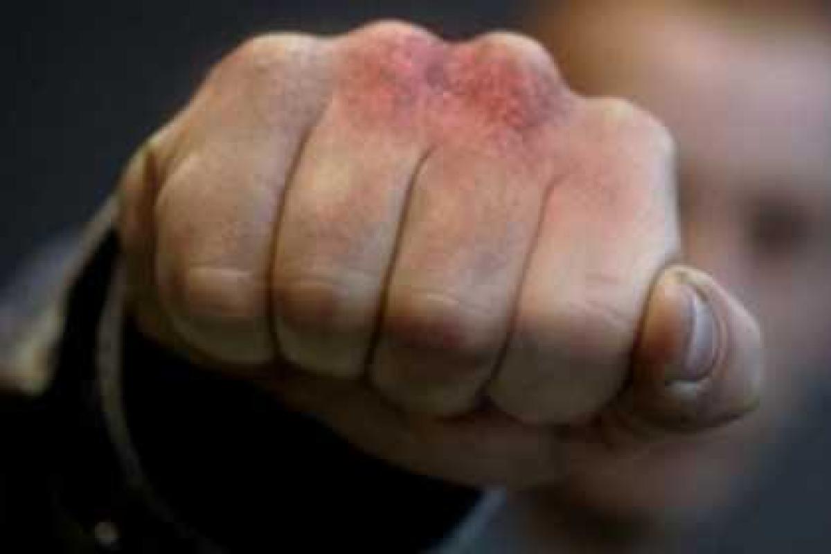 17-летний житель Луцка избил мужчину 