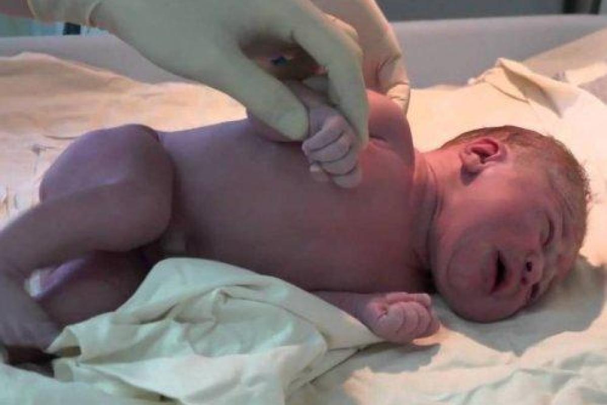 В Рязани медсестра случайно заживо сожгла новорожденного В Рязани медсестра случайно заживо сожгла новорожденного