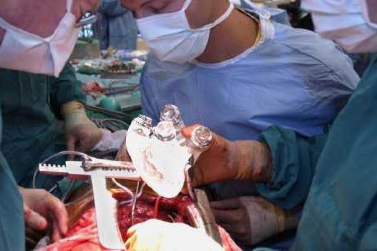 Во Франции умер третий человек с искусственным сердцем 