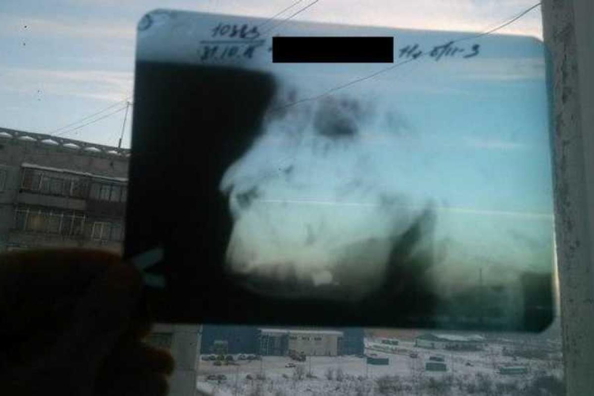 Россиянин выстрелил в лицо 11-летнему мальчику