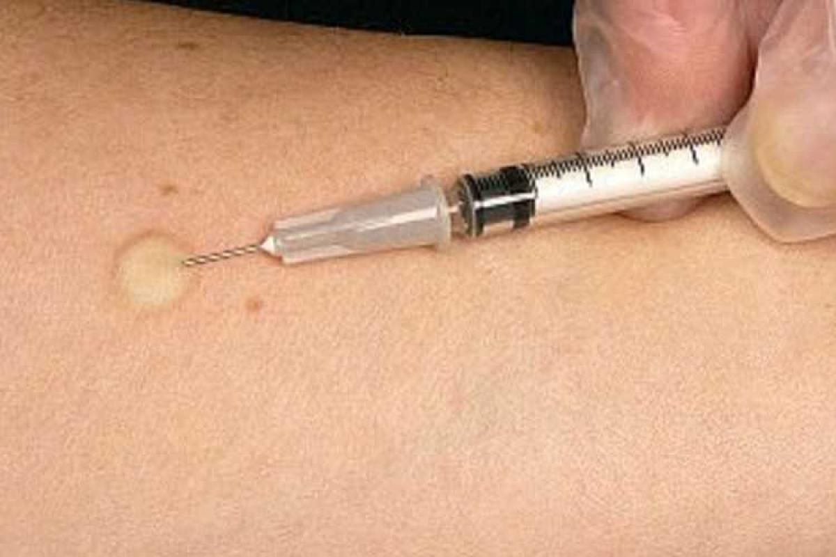 В Смоленске 6-летняя девочка умерла после пробы Манту