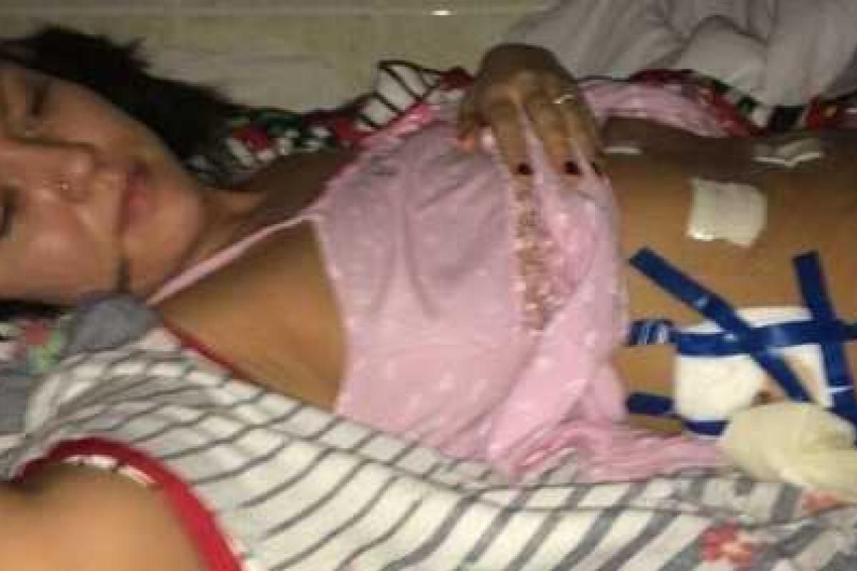 В России пациентке делали послеоперационные перевязки изолентой В России пациентке делали послеоперационные перевязки изолентой