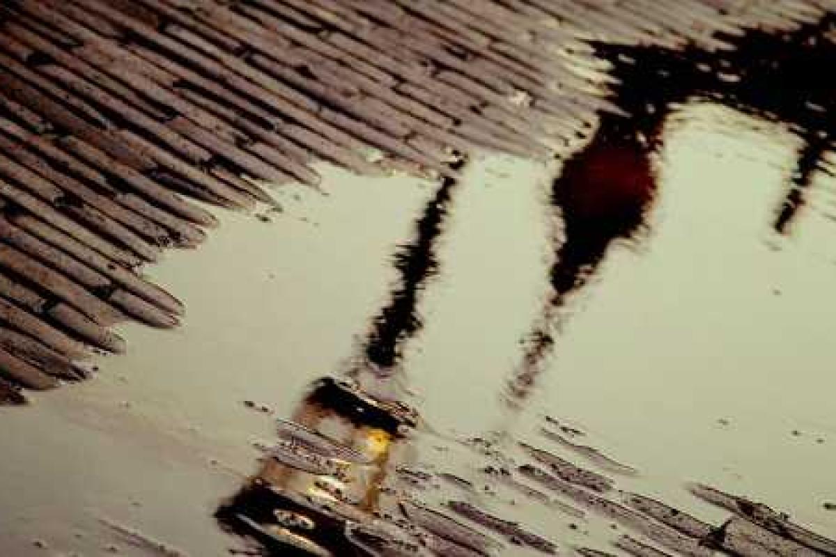 Российская школьница умерла от ожогов после падения в лужу кипятка