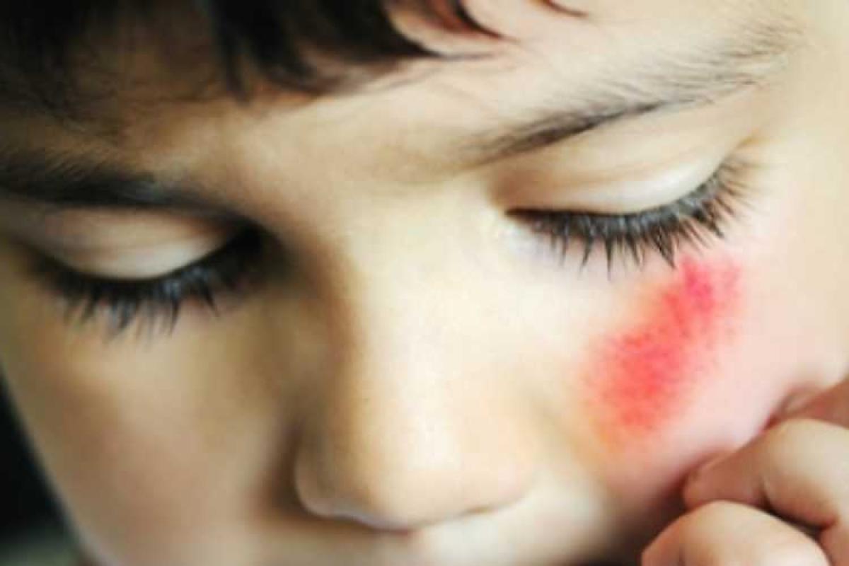 Мальчика, которого у банкомата избила мать-психопатка, оставили в семье