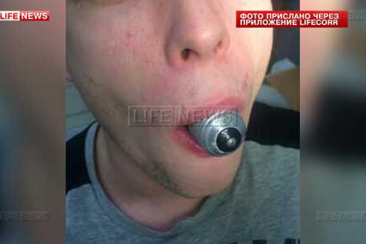 Москвич ради 11 тысяч рублей проглотил лампочку