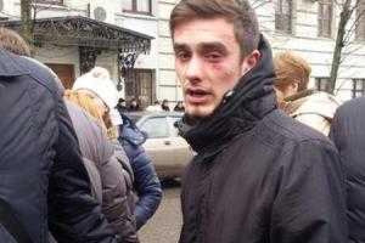 В полиции рассказали о состоянии парня, пострадавшего во время митинга в Харькове В полиции рассказали о состоянии парня, пострадавшего во время митинга в Харькове