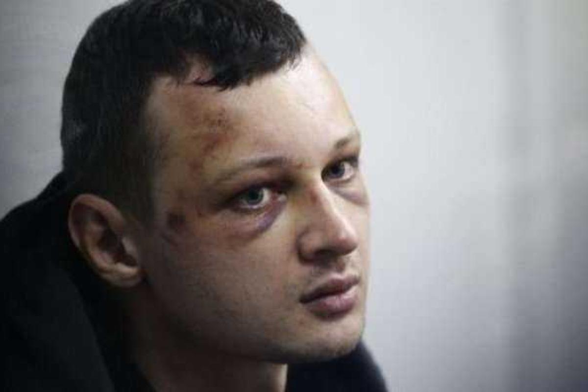 Краснов попал в реанимацию