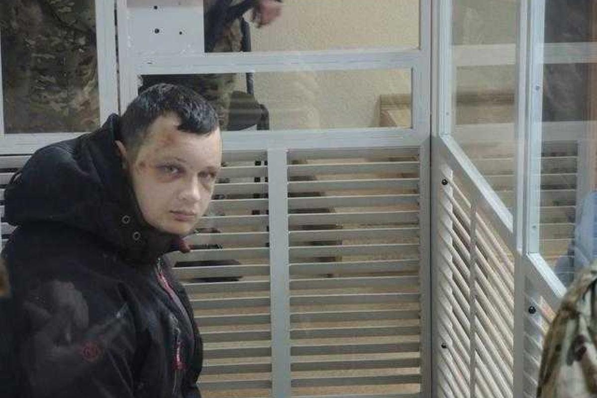 Краснову одели электронный браслет в реанимации Краснову одели электронный браслет в реанимации