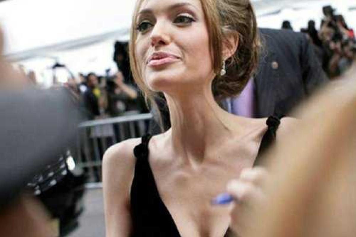 Врачи прокомментировали смертельные диагнозы Анджелины Джоли 