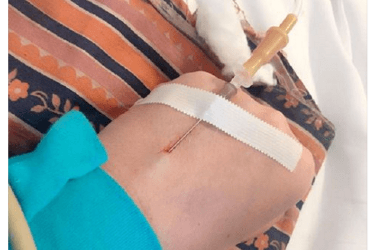 Билык попала под капельницу во время гастролей