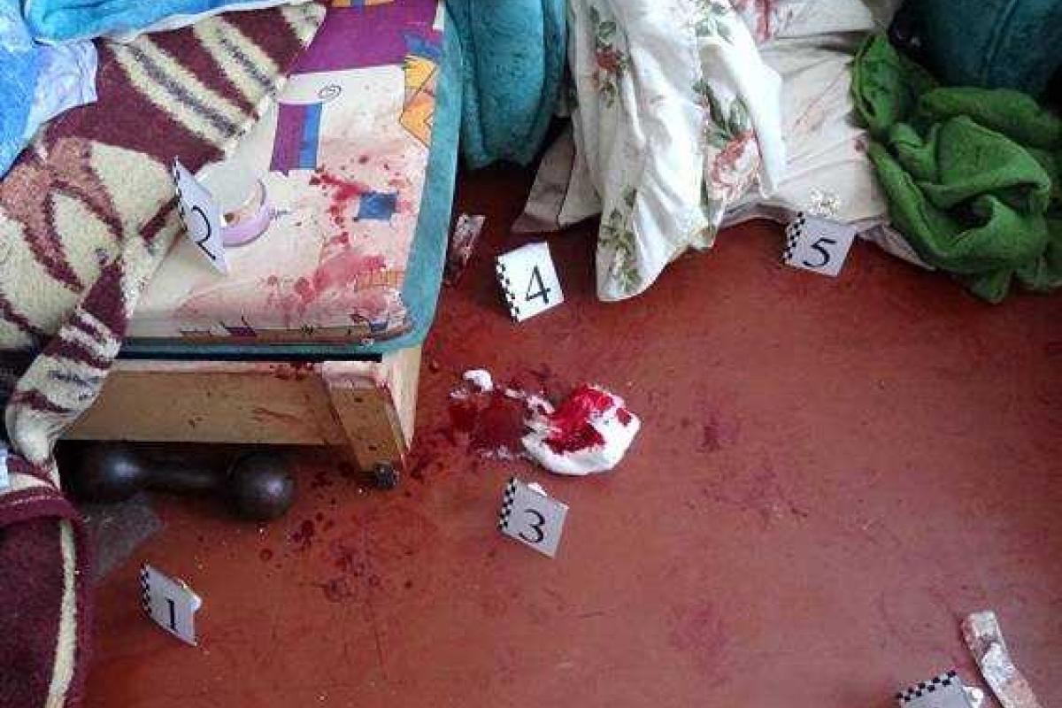 В Киеве 27-летнего мужчину жестоко избили кухонной дощечкой