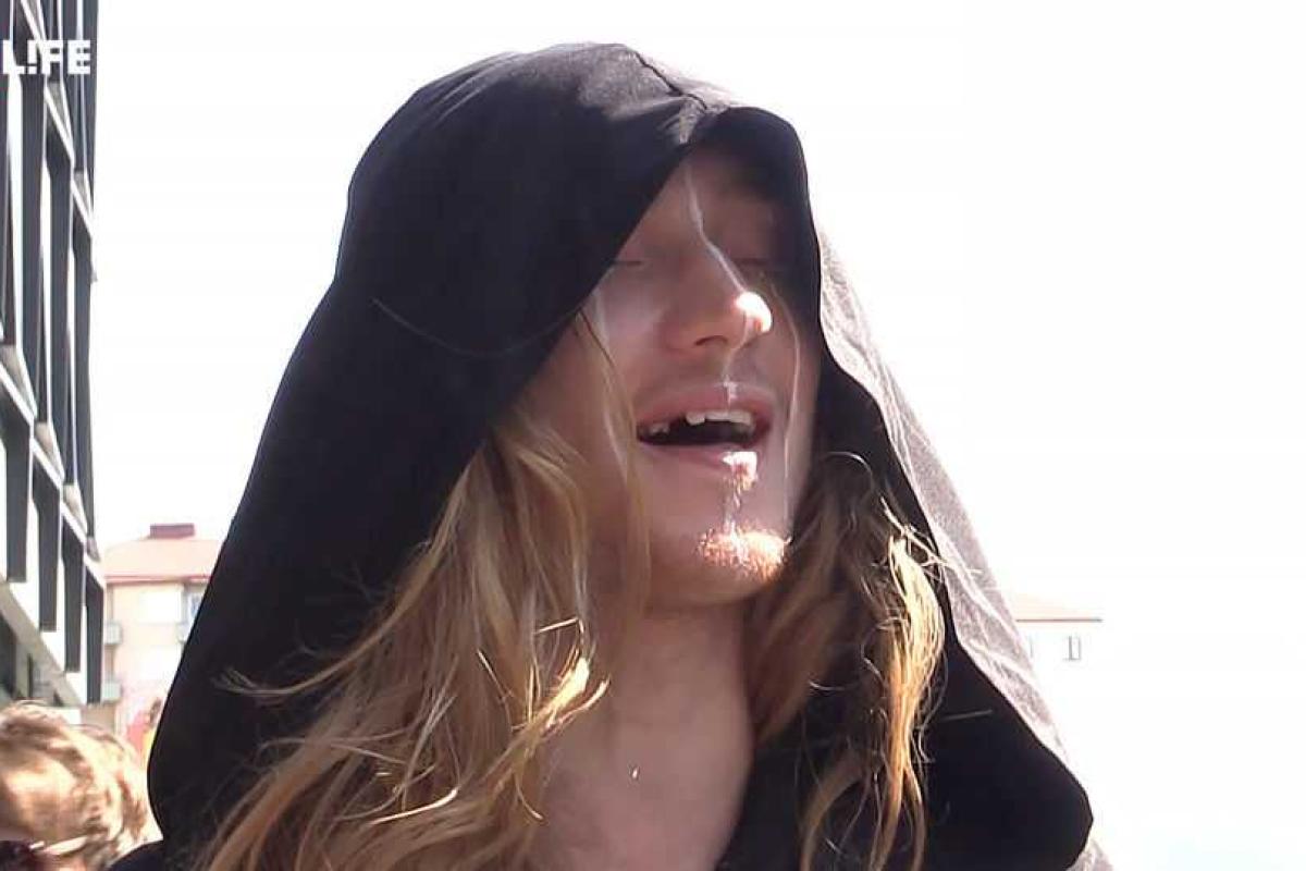 У участника "Евровидения" от Беларуси IVAN'а в 21 год выпадают молочные зубы