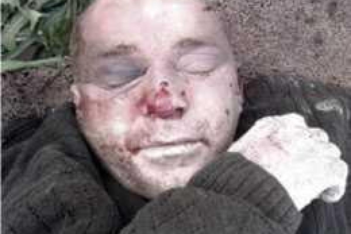 На Донетчине полиция устанавливает личность погибшего мужчины: отрабатываются списки военнослужащих