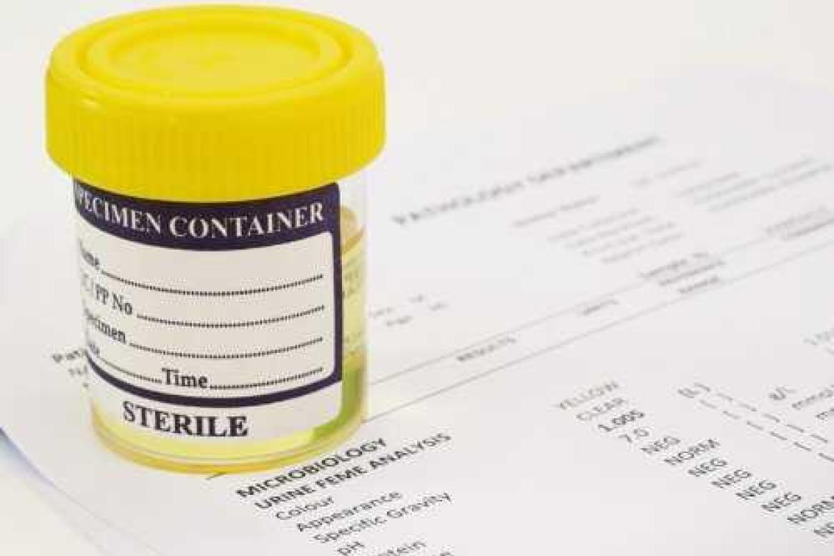 Ученые из Японии разработали метод диагностики рака по анализу мочи Ученые из Японии разработали метод диагностики рака по анализу мочи