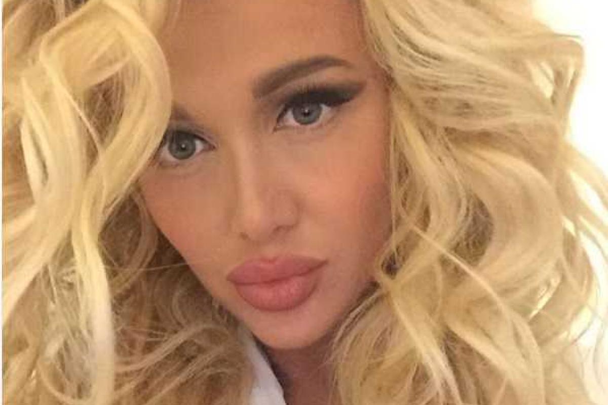 Губы Виктории Лопыревой превратились в пельмени