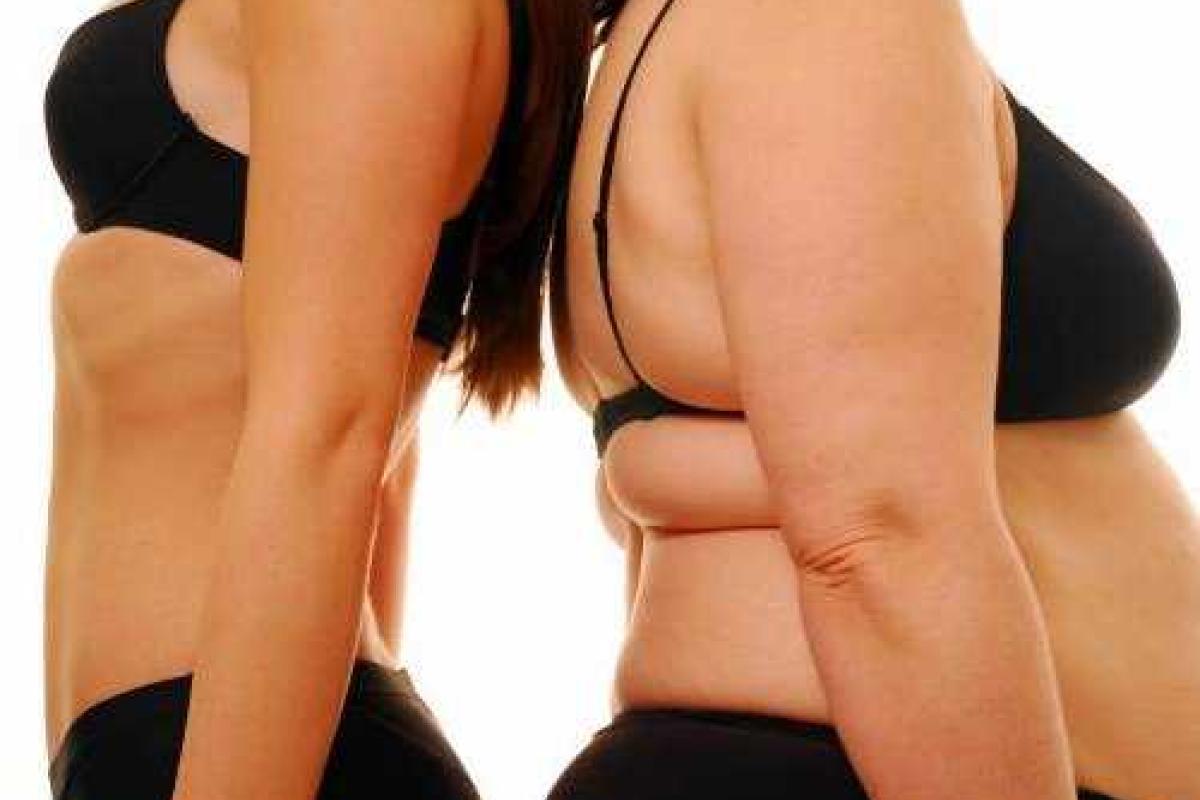 Ученые выяснили главную причину ожирения